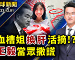【全球新聞】血槽姐享副國級待遇 涉換肝活摘？
