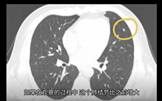 【一線採訪】知情人：單位95%的人查出肺結節