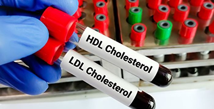 New Study: High Levels of ‘Good Cholesterol’ Linked to Dementia Risk – Experts Divided on Findings