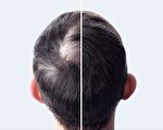 老化導致頭髮脫落、變白 7種營養素讓頭髮回春