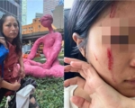 紐約市無證移民襲擊華裔女 搶傘割臉