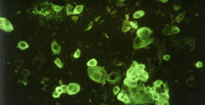 科学家在20亿年前岩石中发现活微生物