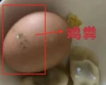 寧波市民花27萬送父母進養老公寓 飯菜有蝸牛