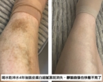 通向健康长寿 打开细胞的“水之门”