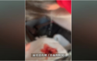 遼寧鐵嶺一私家車撞入醫院大廳 至少1死1傷