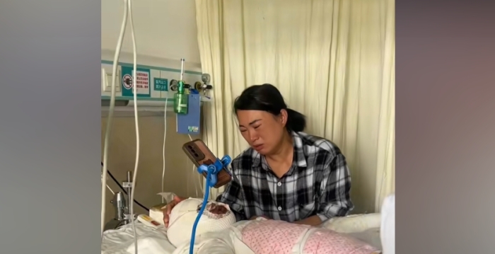 河南8岁女孩开灯引发煤气爆炸 身体58%烧伤