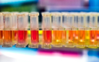 COVID-19新变种来袭 专家支招如何缓解症状