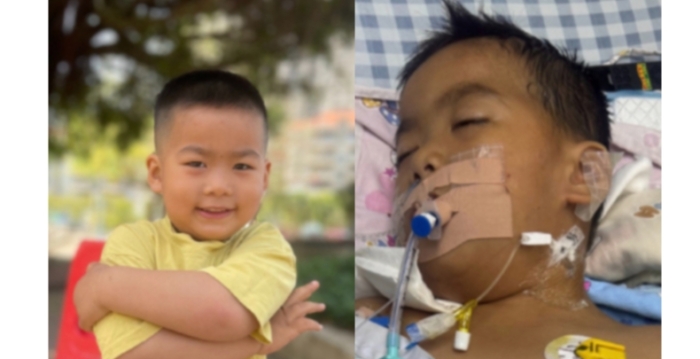 扁桃体微创手术后 广东3岁男童竟“脑死亡”