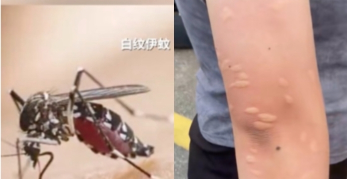 广东双疫情警报 登革热飙升 基孔肯雅热蔓延