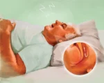 阻塞性睡眠呼吸暫停症：原因以及治療方法