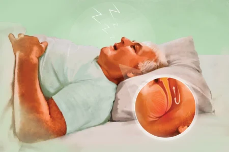 阻塞性睡眠呼吸暂停症：原因以及治疗方法