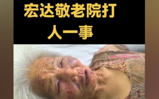 山西運城85歲老人在養老院遭毆打 多處骨折