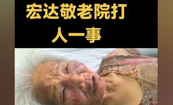 山西运城85岁老人在养老院遭殴打 多处骨折