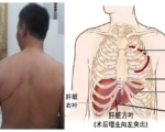 张菁：内蒙集中采集男性血样背后的罪恶