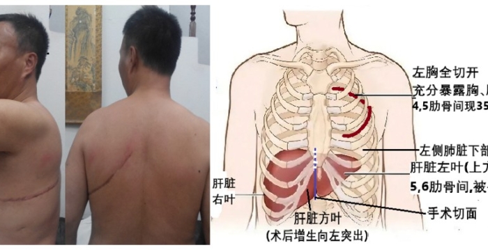 张菁：内蒙集中采集男性血样背后的罪恶