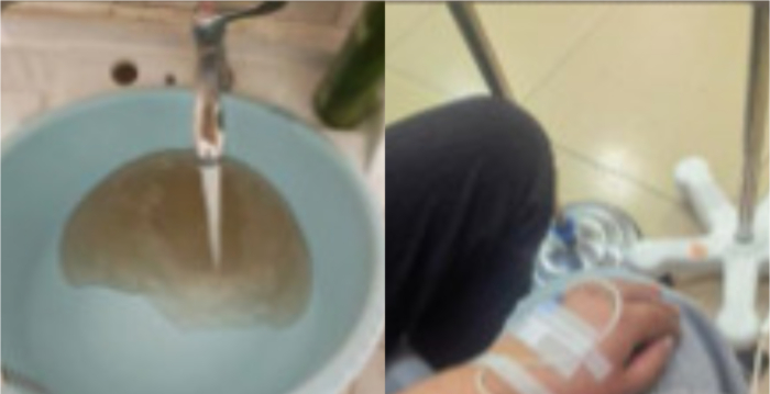 山东滨州职业学院集体腹泻 四百余人次就诊