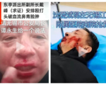 转业军人沈爱斌遭无锡一派出所殴打 重伤住院