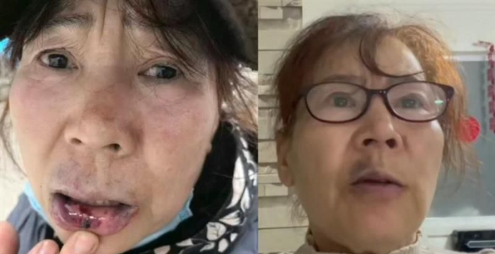 山东夫妻在京遭绑架 妻子脱困后寻找目击证人