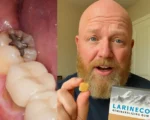 修复蛀牙的最好方法？每天嚼这种口香糖