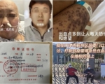 天津男子打疫苗后患白血病 死于“维稳病房”