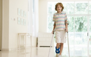 脚扭伤肿成两颗网球大 为什么不能立刻针灸？