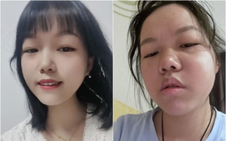 湖北疫苗受害者长期遭打压 身心疲惫