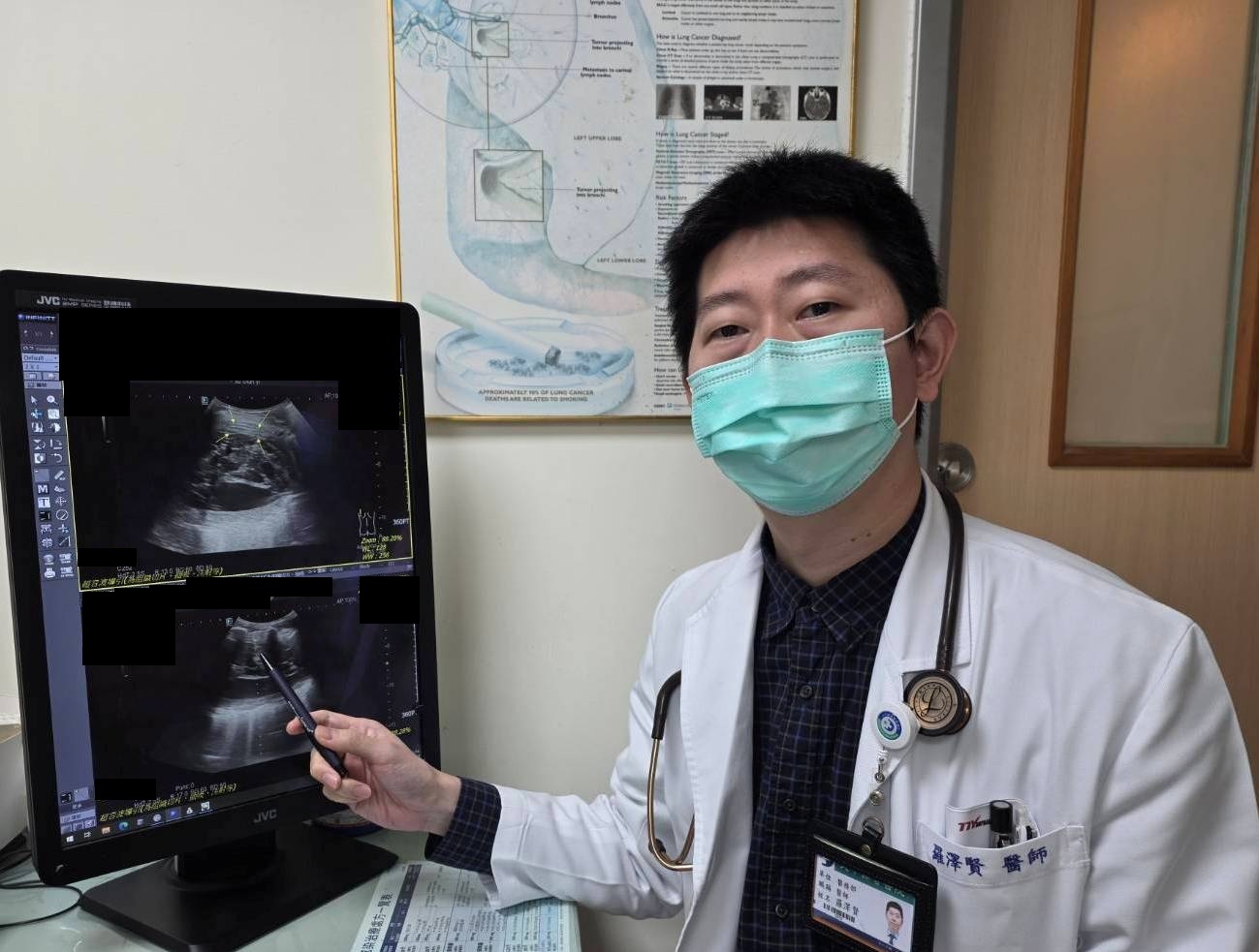 苗栗医疗新突破！超音波导引切片技术肺癌诊断更精准安全| 微创| 大纪元