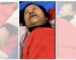 江苏当局干预医疗 访民脑出血不让住ICU