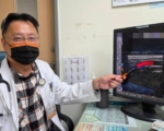 糖尿病男颈动脉完全阻塞险中风 紧急精密手术 重建脑血流