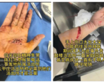 中共兩會 訪民被暴力維穩導致精神失常