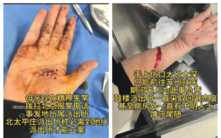 中共兩會 訪民被暴力維穩導致精神失常