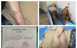 住酒店發生糾紛 湘訪民胡正秋遭警察毆打致暈